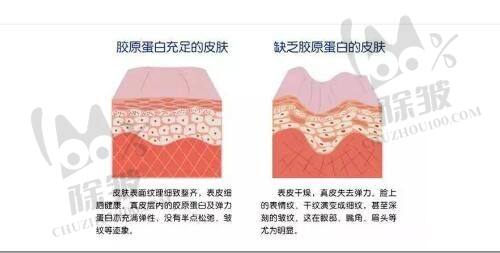 郑州整形美容医院排名前十位中的眼部整形项目优势
