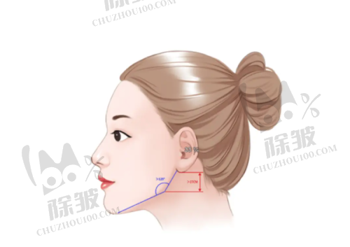 郑州整形美容医院排名前十位中的抽脂项目优势