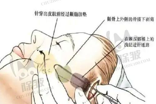 新疆乌苏优兰卡医疗美容诊所真人口碑评价怎么样？