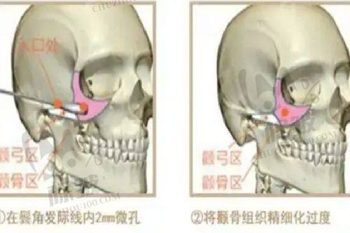 七台河整形美容医院的其他优势项目