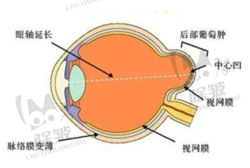 2025昆明红会眼科医院近视手术排队攻略