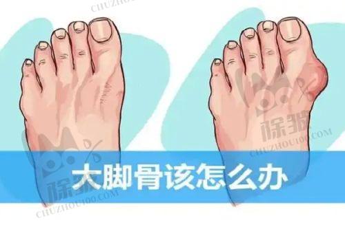 2025新版沈阳杏林整形美容医院价格表之吸脂及脂肪填充项目