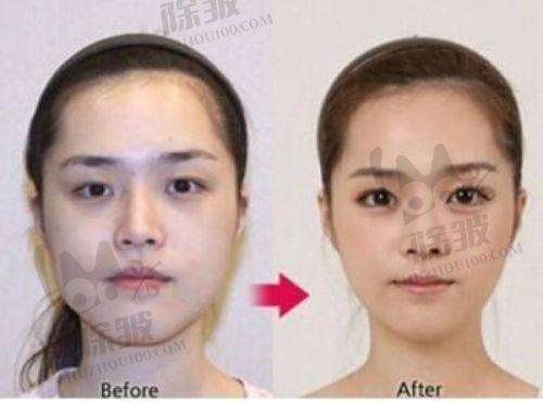 深圳美加美医疗美容的服务与口碑