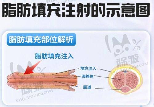 总结