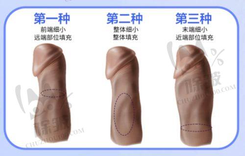 2025北京比较靠谱的整容医院中的面部提升项目