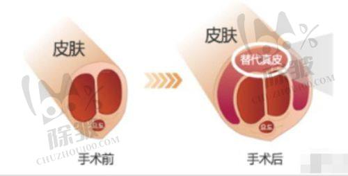 温州国内外和平医院真人实例多