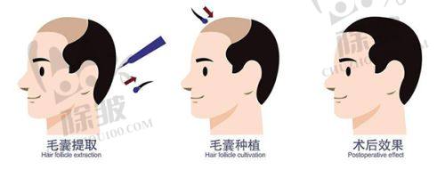 2025天津整形医院中的皮肤管理项目