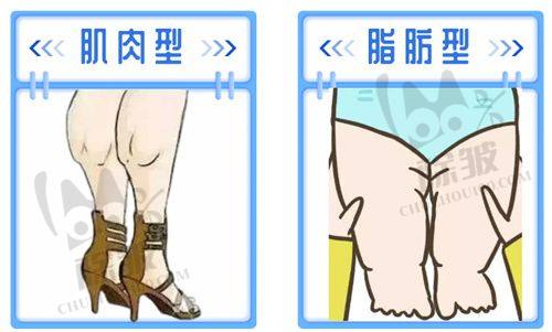 吉林大学第(一)医院整形美容外科胸部项目价格表