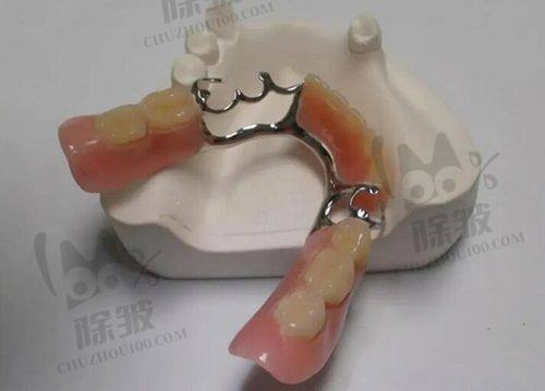 东莞十大口腔医院排名榜中的种牙项目