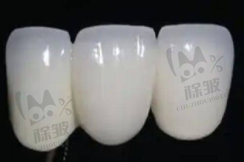 桐乡松丰口腔的服务质量保护