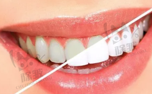 桐乡松丰口腔的价格体系合理性