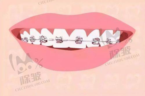义乌义惠口腔门诊部收费价格与特色