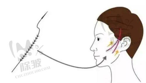 乔雅登4号维持时间