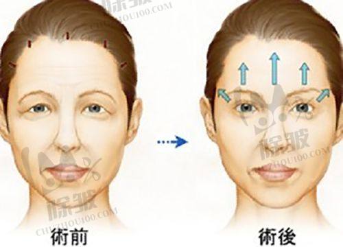深圳美加美医疗美容的主推项目