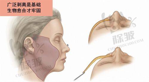 武汉祛疤哪个医院比较好——壹加壹医疗美容