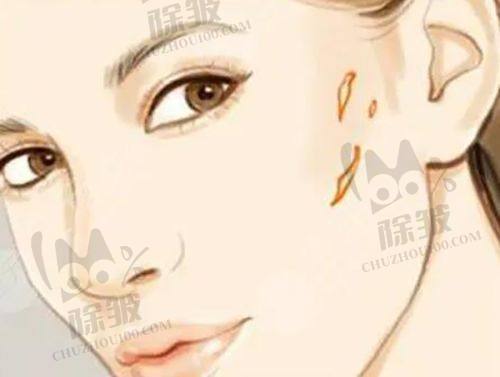 2025新版沈阳杏林整形美容医院价格表之胸部整形