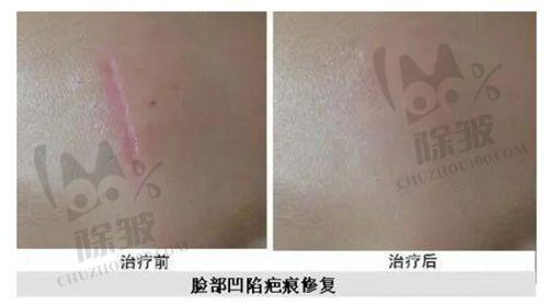 2025新版沈阳杏林整形美容医院价格表之除皱及微创整形美容项目