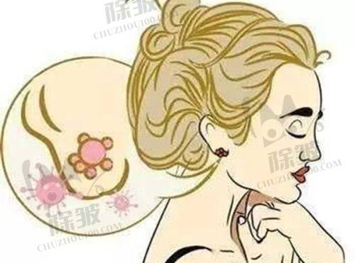 吉林大学第(一)医院整形美容外科鼻部项目价格表