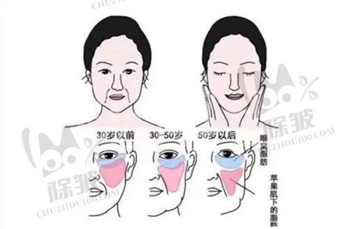 黄寺整形美容医院院长杜太超医生小拉皮手术的修复情况
