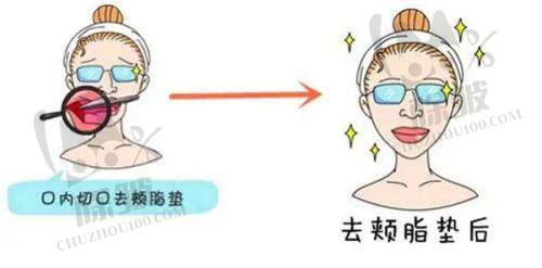宁波奉化珐丽医疗美容门诊部是正规医院吗？