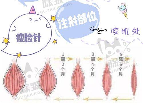荔湾区人民医院美容科齐云香医生实力