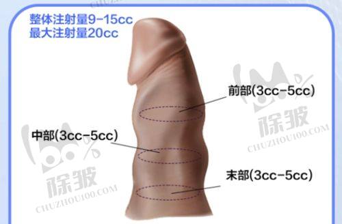 温州艺星整形医院的整形项目有哪些