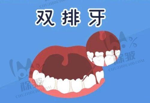 石家庄永齐口腔不是骗人的,连锁分院更便利