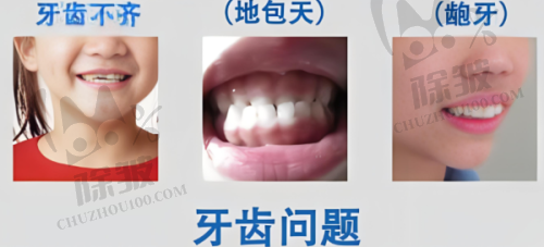 淮安牙知道口腔补牙项目亮点