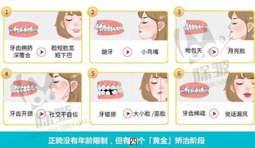 总结与选择建议