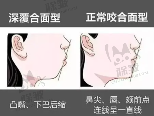 北京劲松口腔医院的收费情况