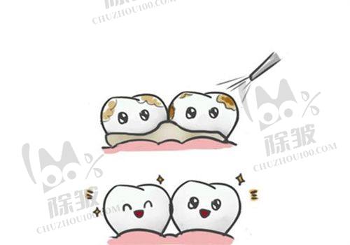 深圳穗华口腔价格情况介绍
