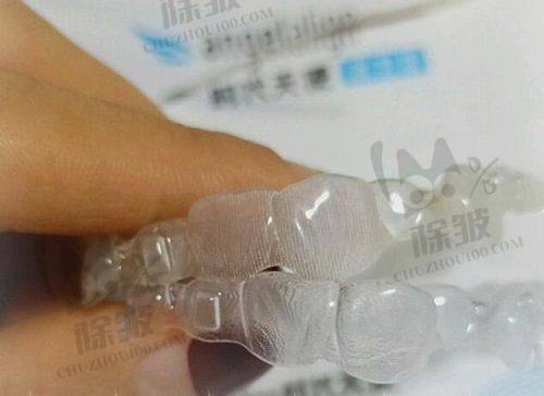 北京牙元素口腔的种植牙特色技术如何