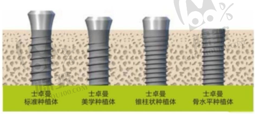 市民朋友对美国皓圣种植牙的评价
