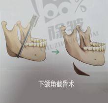 荔湾区人民医院美容科收费标准及服务质量