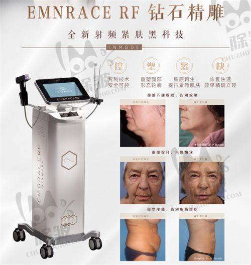 菲林普利隆鼻7500元起