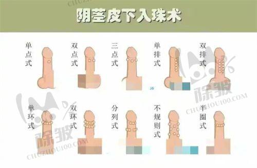 武汉不同医院乳房提升价格差异原因