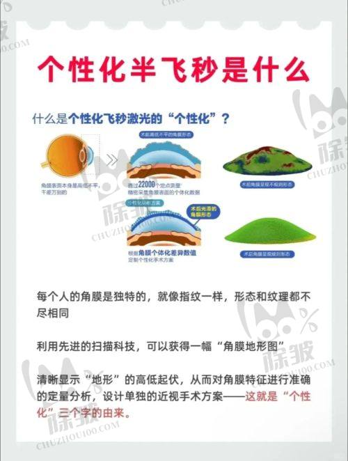 2025西安四院眼科近视手术报销细则