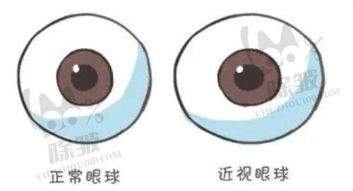 兰州华厦眼科白内障手术项目:专精应对多种情况