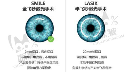 兰州华厦眼科近视手术项目:技术精良成效好