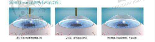 兰州华厦眼科其他优势:设备精良公益多