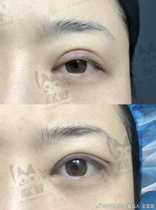 大连爱德丽格王鹤霏医生的简历及技术荣誉展示