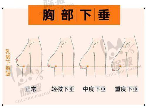 镇江苏王做觉醒玻尿酸项目的技术优势