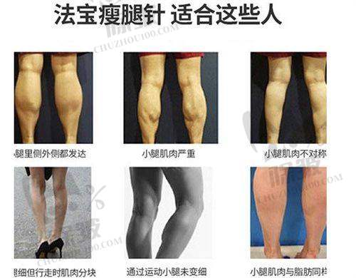 襄阳xx整形医院与奥地利公主玻尿酸项目相关其他类型的收费价格参考