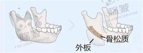 镇江苏王觉醒玻尿酸项目推荐医生及优势