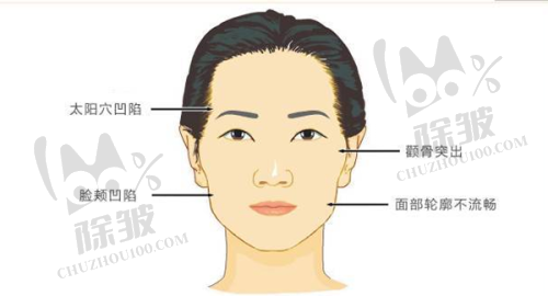 3DEEP黄金微针之祛除皱纹