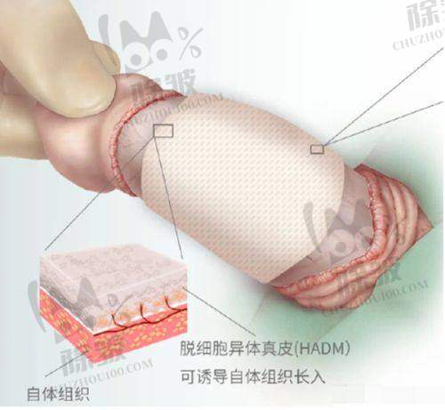 上海今识整形医院微整形技术优势