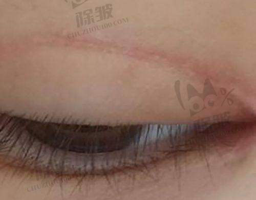 不同皮肤问题的治疗方案，针对性解决肌肤困扰