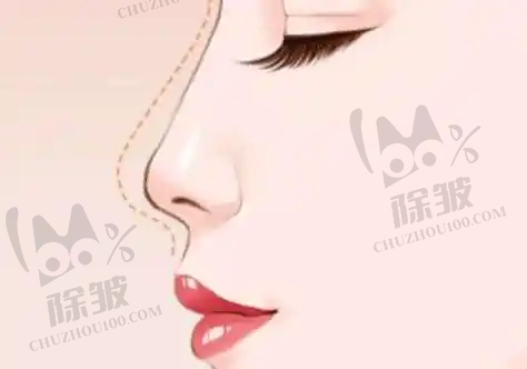 长春海峡整形医院割双眼皮顾客满意度情况