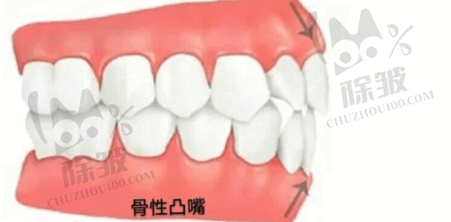 石家庄三博口腔医院牙齿矫正价格详情
