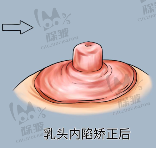 杭州维多利亚整形医院